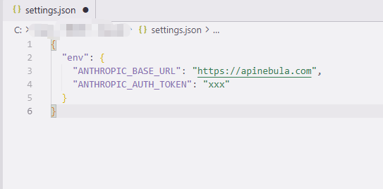 写入 settings.json